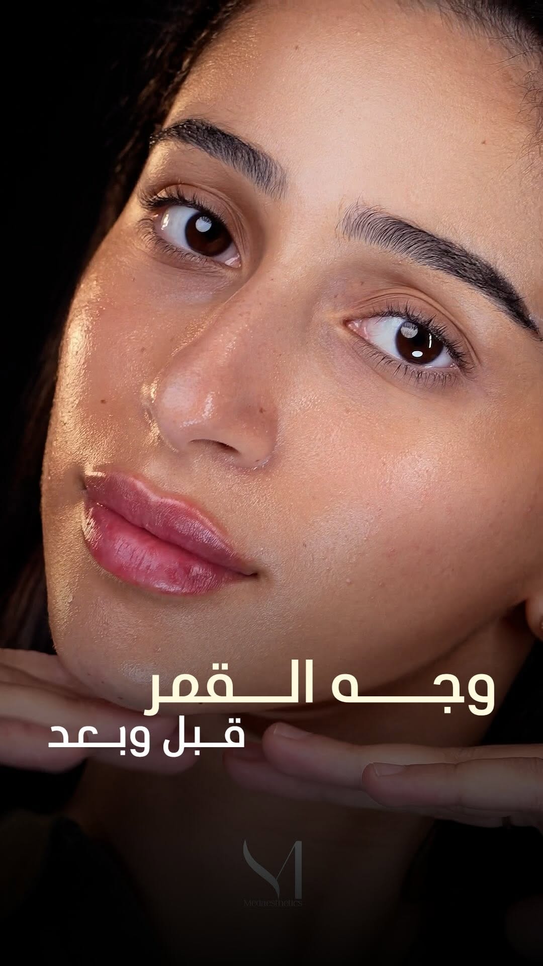 Post 8 by Dr.Rahaf Ali| د.رهف علي on Instagram (video)