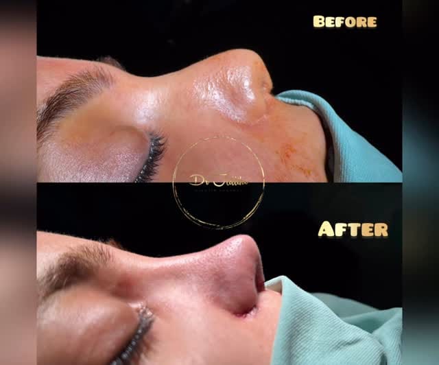 Post 7 by Dr Ahmad Jalliko on Instagram (video)