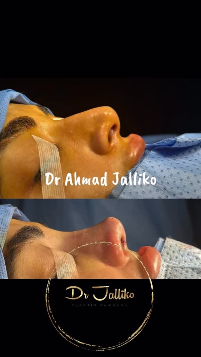 Post 9 by Dr Ahmad Jalliko on Instagram (video)