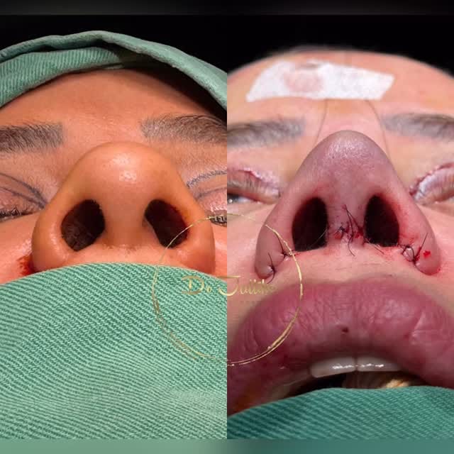 Post 2 by Dr Ahmad Jalliko on Instagram (video)