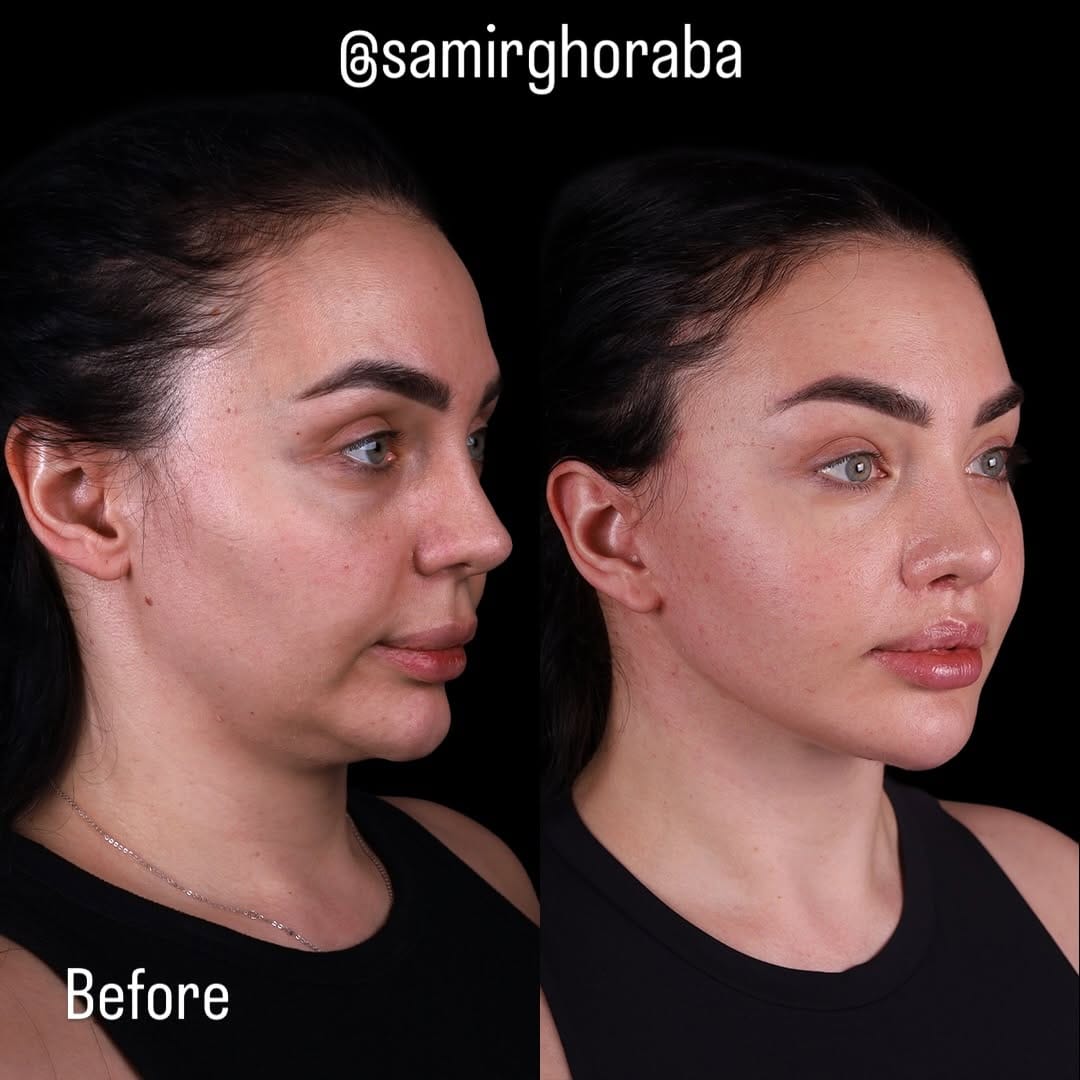 Post 2 by Dr.Samir Ghoraba د.سمير غرابة on Instagram (carousel)