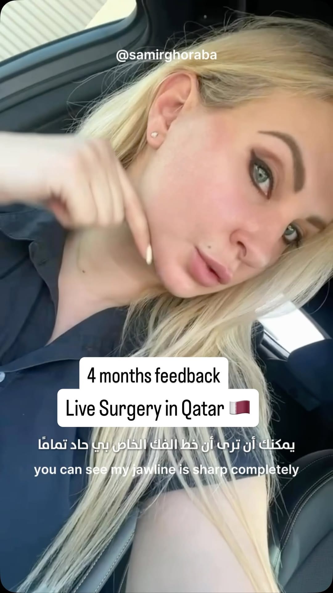 Post 6 by Dr.Samir Ghoraba د.سمير غرابة on Instagram (video)