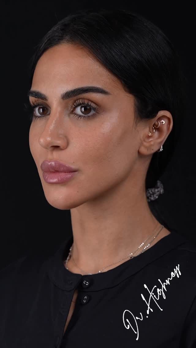 Post 5 by Dr Firas Hamdan د. فراس حمدان on Instagram (video)