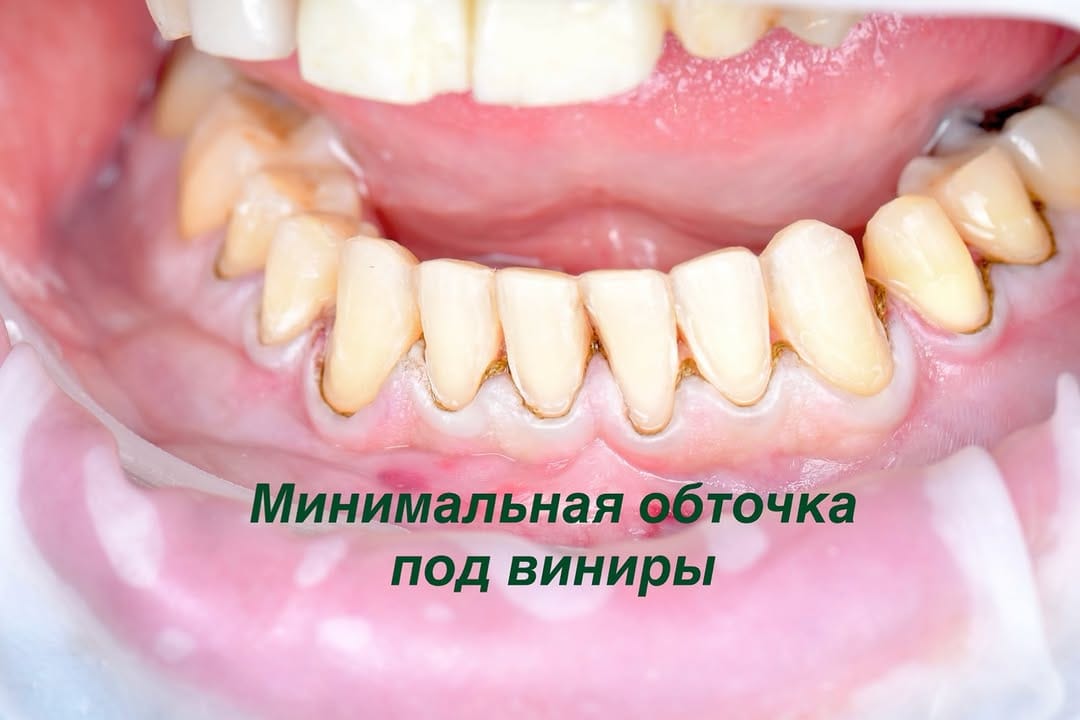 Post 2 by Klareta Refaai on Instagram (image)