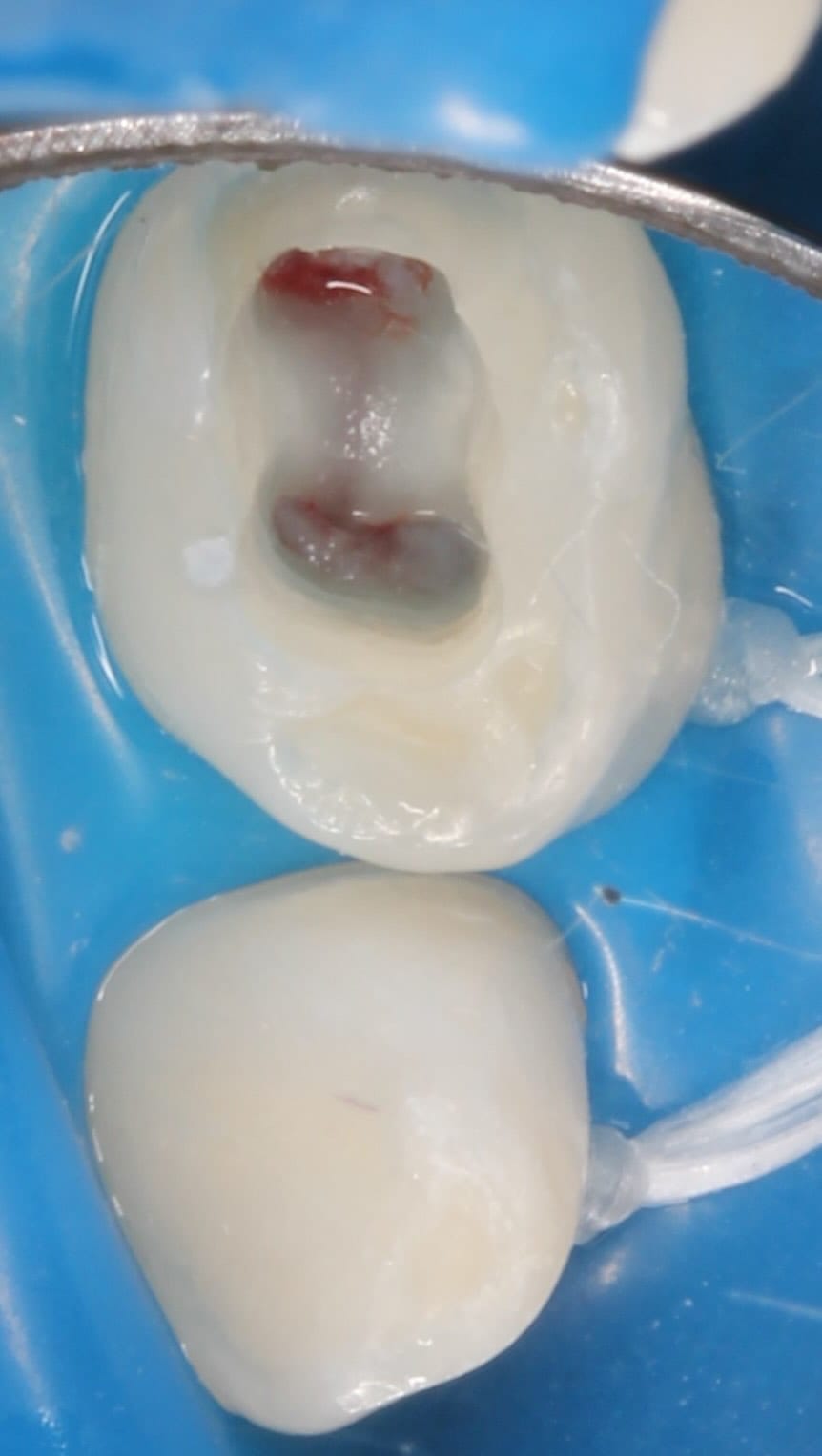 Post 1 by Dentist in Dubai on Instagram (video)