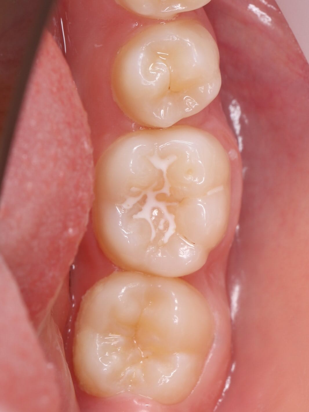 Post 3 by Dentist in Dubai on Instagram (carousel)