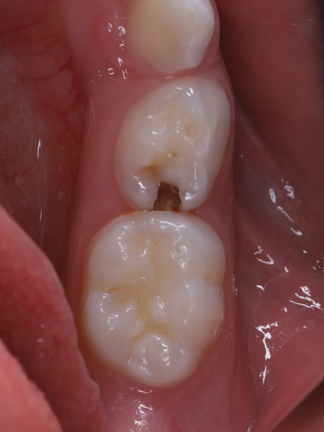 Post 7 by Dentist in Dubai on Instagram (carousel)
