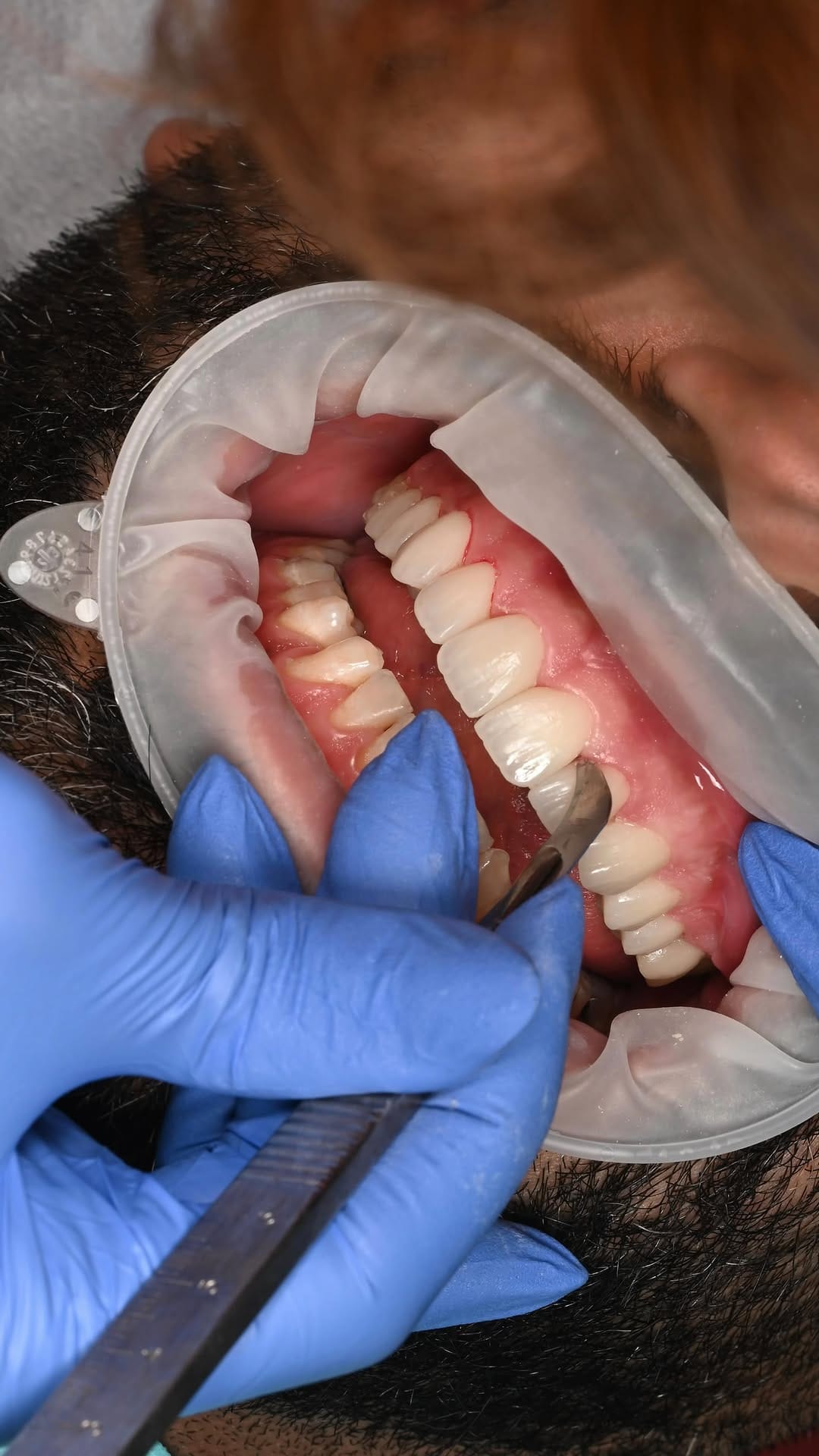 Post 6 by Dr.Diana Hakimpour on Instagram (video)