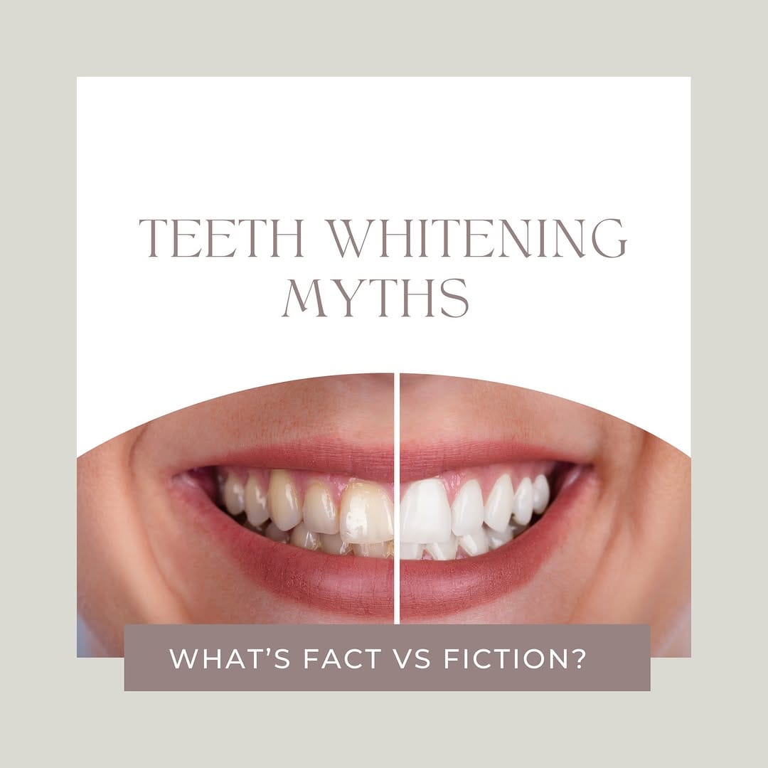 Post 4 by TMJ/ Cosmetic Dentist Beverly Hills/ Dr. David Frey DDS on Instagram (carousel)
