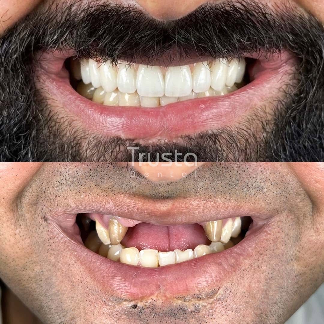 Post 3 by ایمپلنت شیراز عرفان صفری on Instagram (image)
