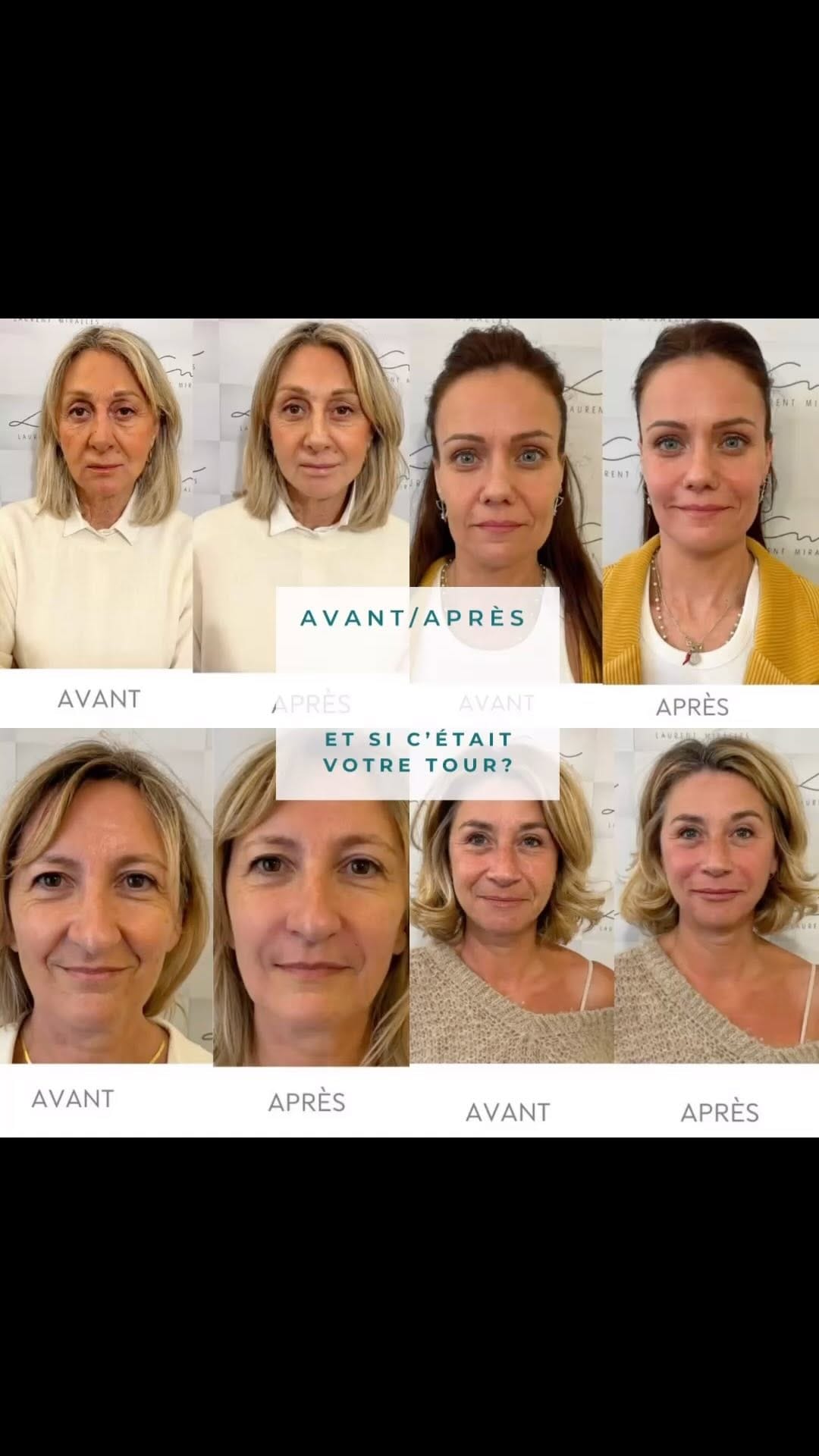 Post 8 by Dr. Laurent Miralles on Instagram (video)