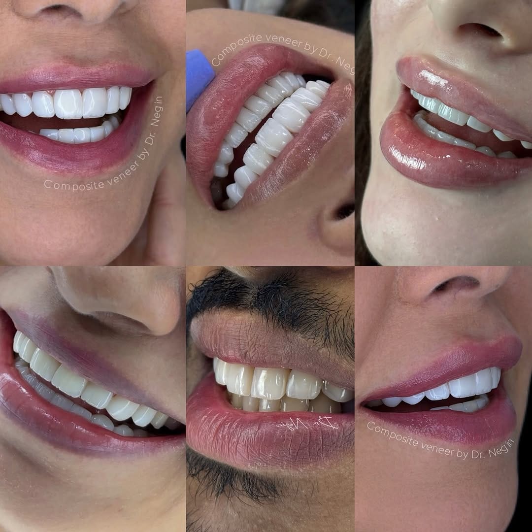 Post 8 by Dr. Negin Shahabzadeh , BDS on Instagram (image)