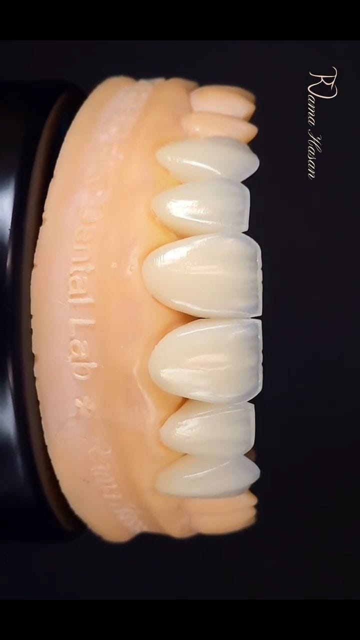Post 1 by Dt. Rama Hasan on Instagram (video)