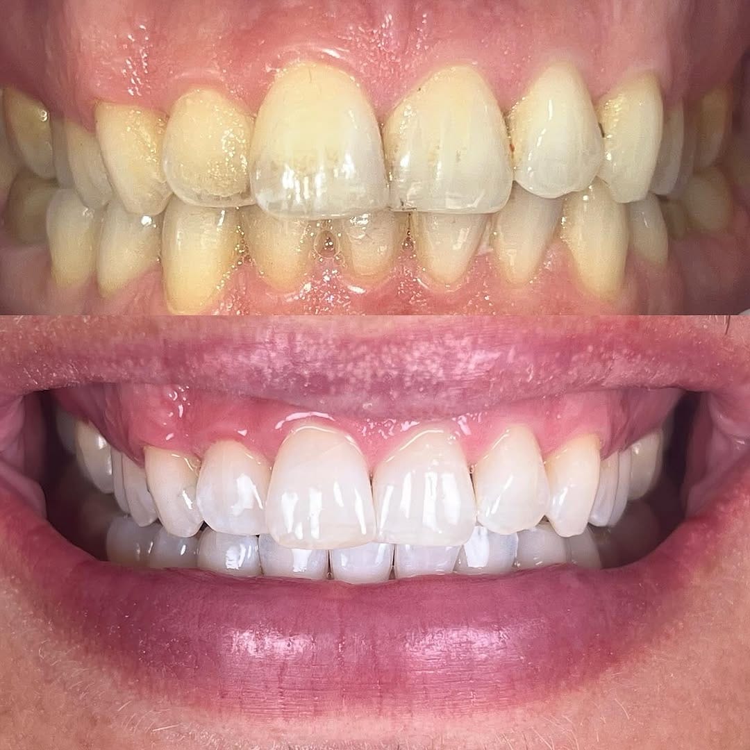 Post 9 by Dr. Egle Simkute cosmetic dentist Dubai on Instagram (image)
