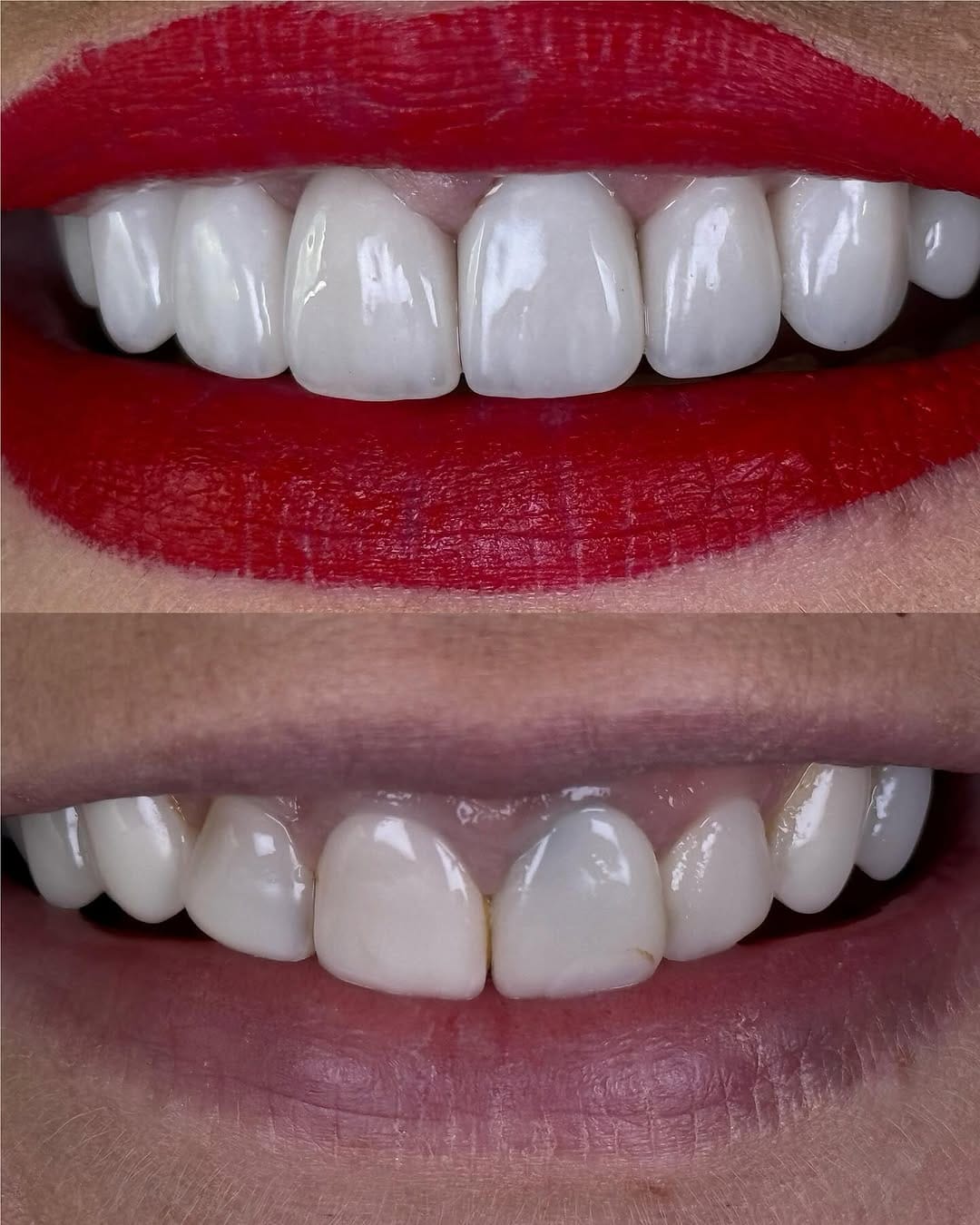 Post 6 by Dr. Egle Simkute cosmetic dentist Dubai on Instagram (image)