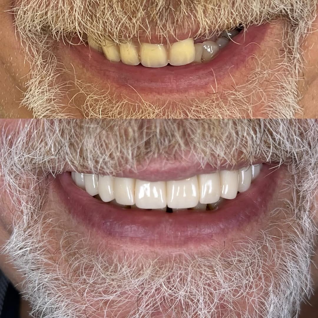 Post 7 by Dr. Egle Simkute cosmetic dentist Dubai on Instagram (carousel)