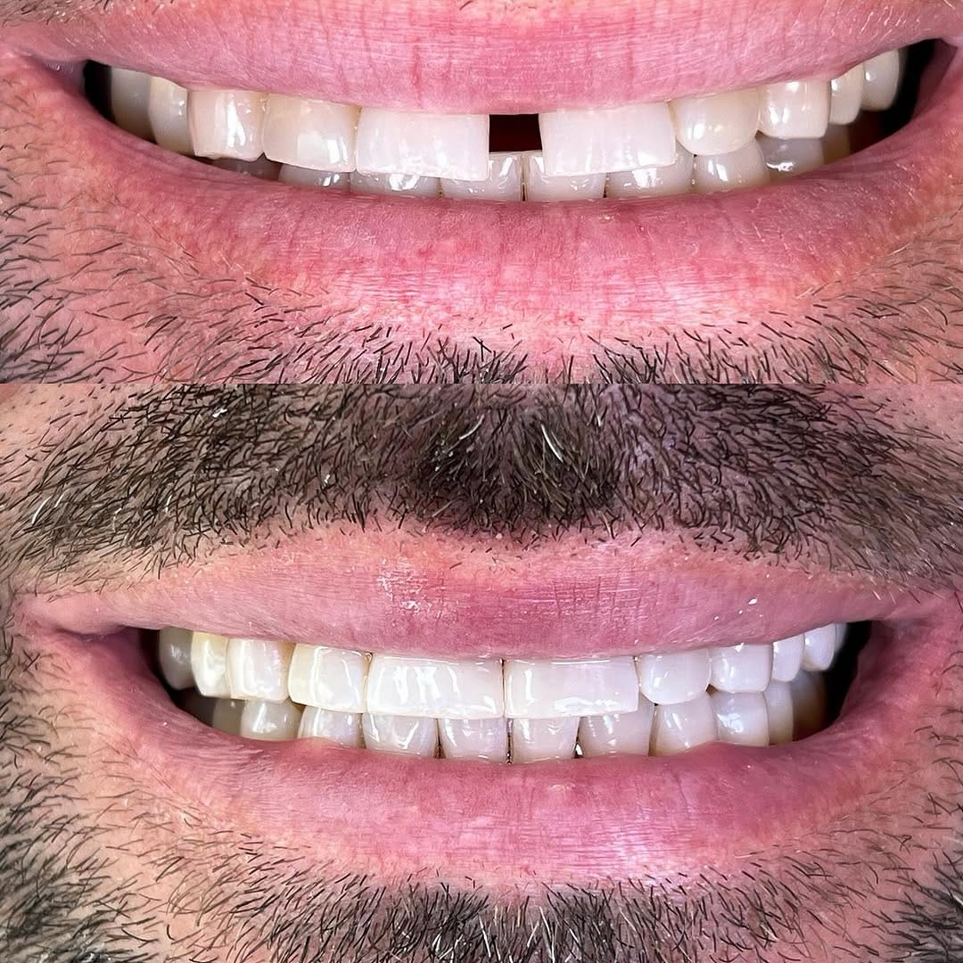 Post 10 by Dr. Egle Simkute cosmetic dentist Dubai on Instagram (image)