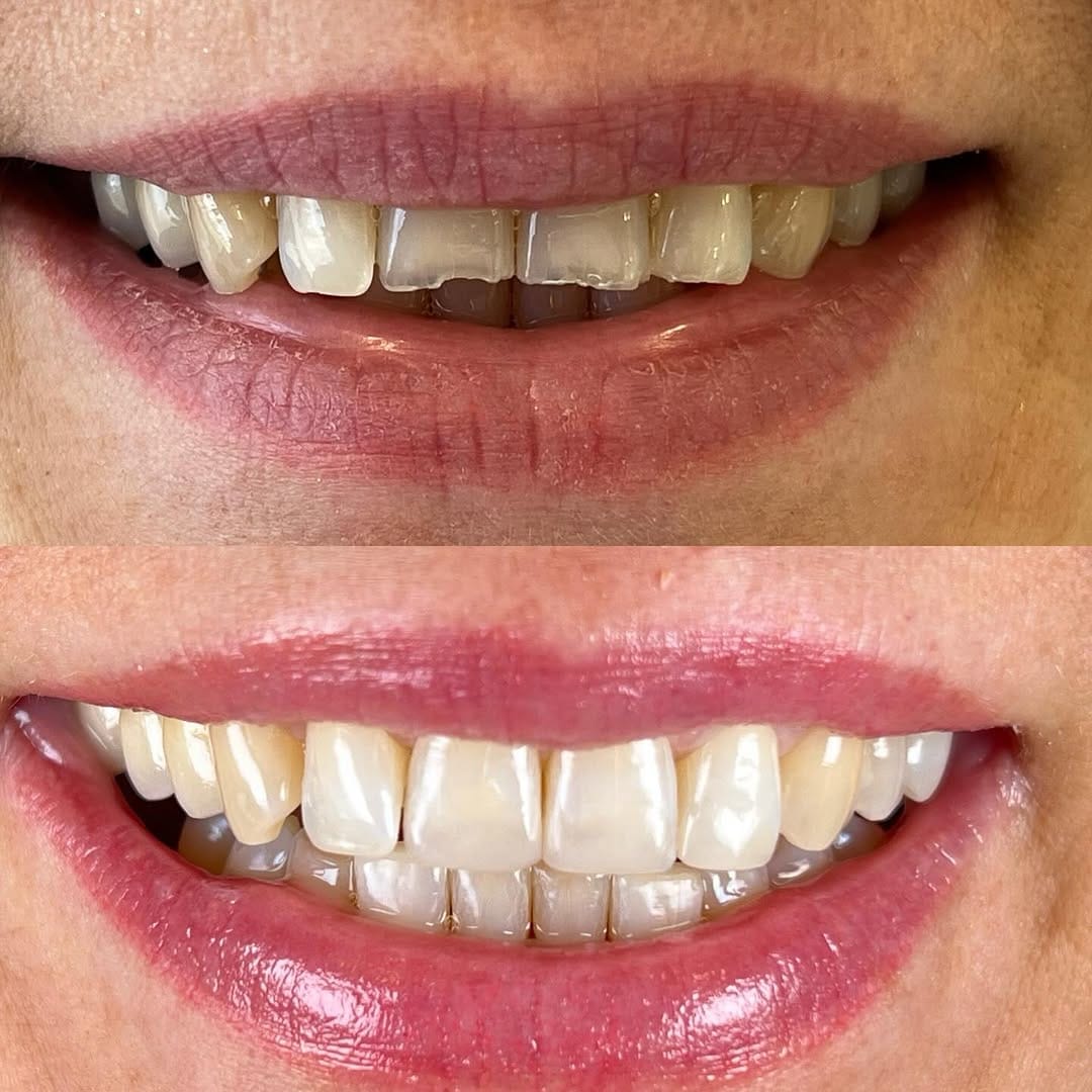 Post 2 by Dr. Egle Simkute cosmetic dentist Dubai on Instagram (image)