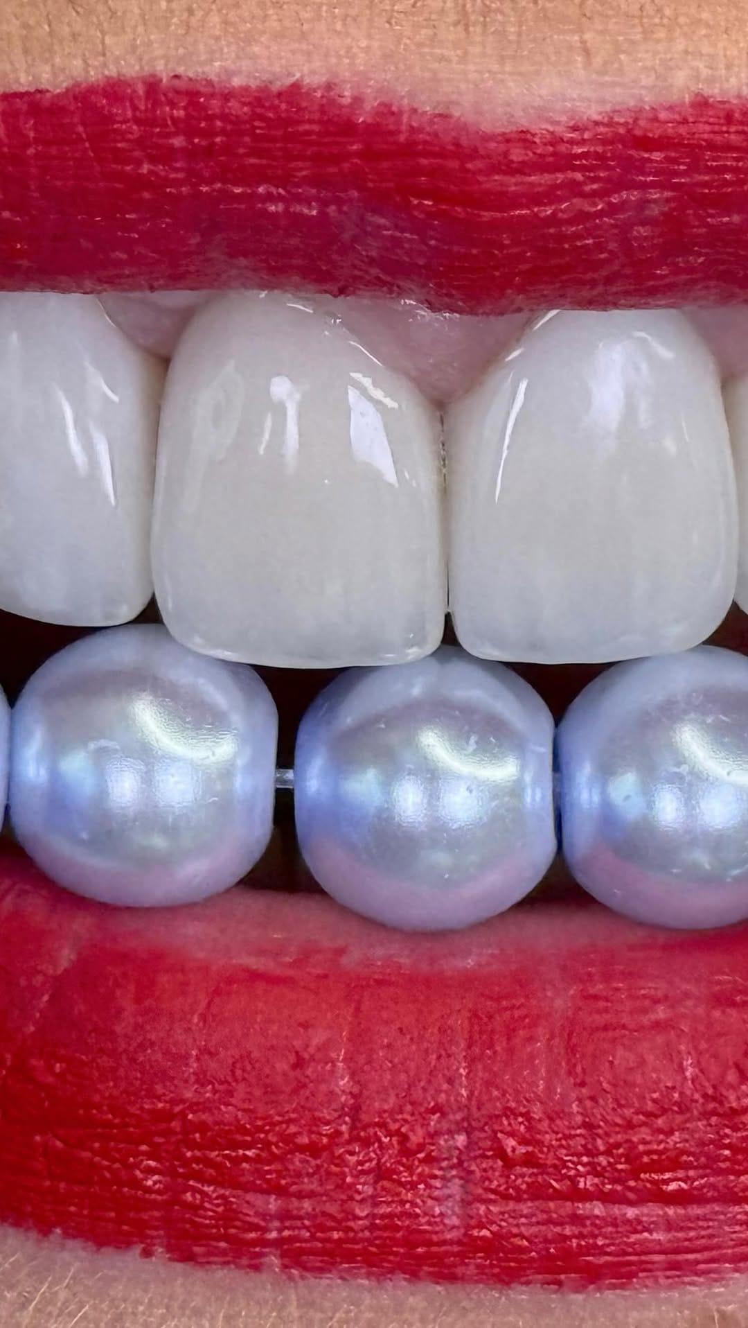 Post 5 by Dr. Egle Simkute cosmetic dentist Dubai on Instagram (video)
