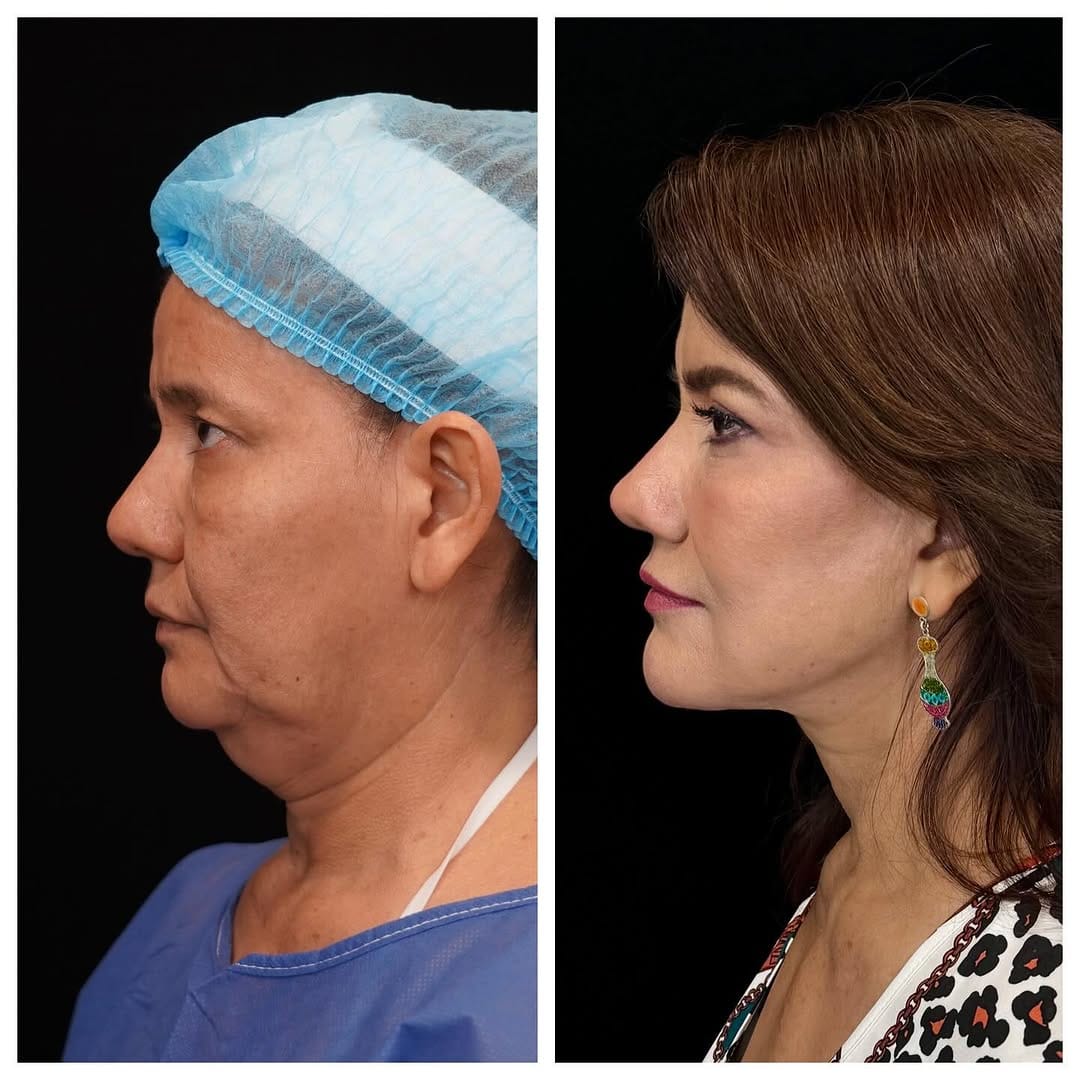 Post 10 by Dr. Juan Pablo Menéndez on Instagram (carousel)