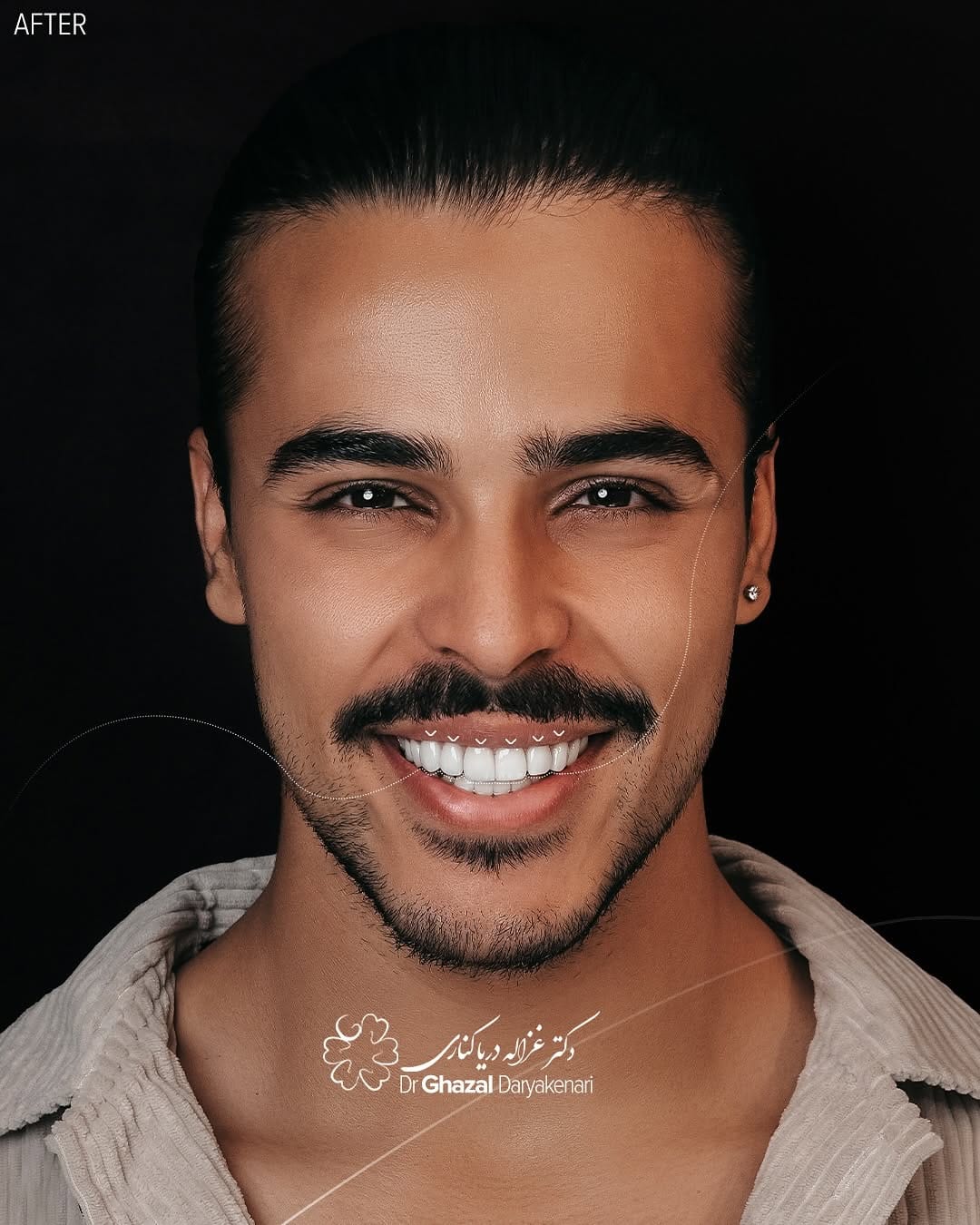 Post 5 by دکتر غزاله دریاکناری on Instagram (carousel)