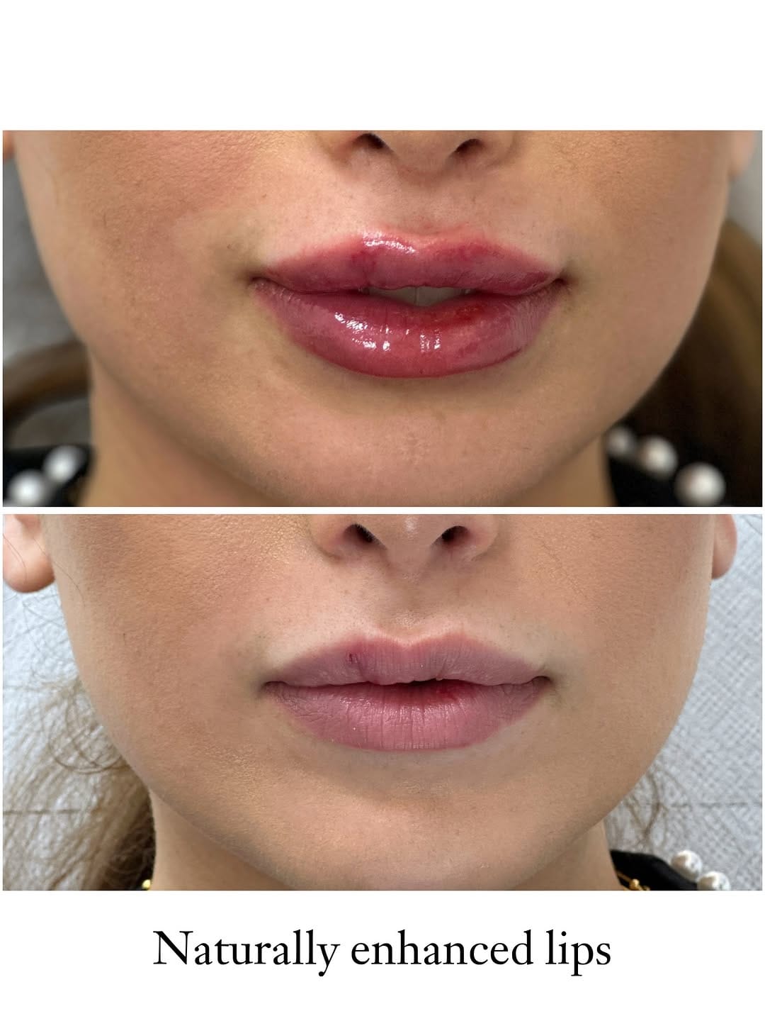 Post 6 by Dr. Beyan El Emin | Dermatology & Aesthetics on Instagram (image)