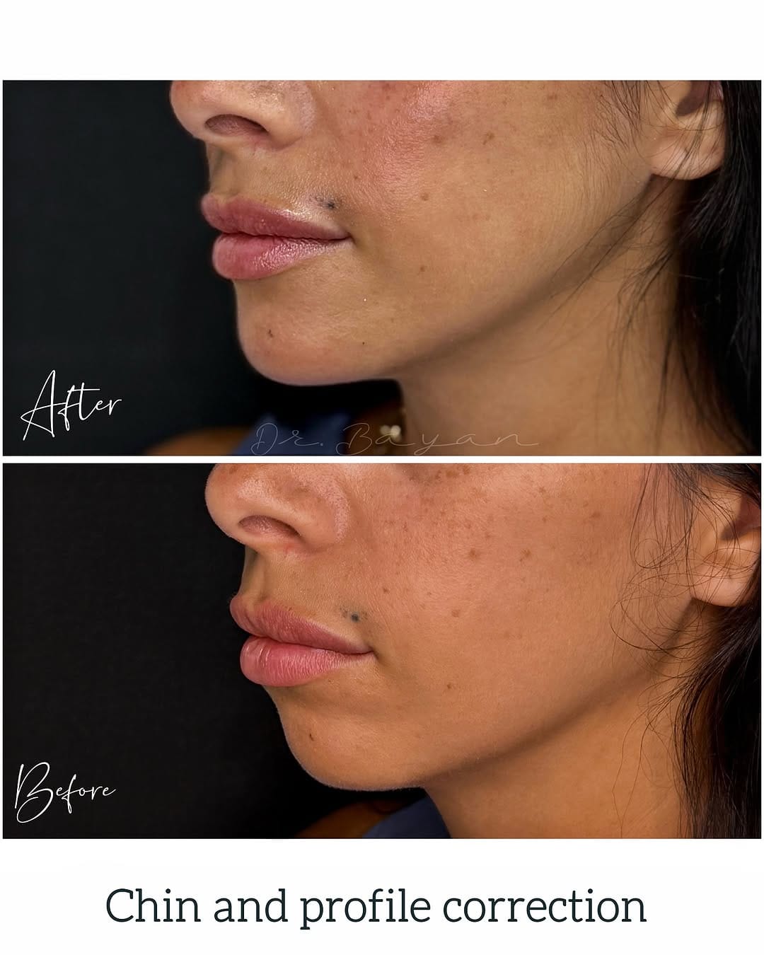 Post 9 by Dr. Beyan El Emin | Dermatology & Aesthetics on Instagram (image)
