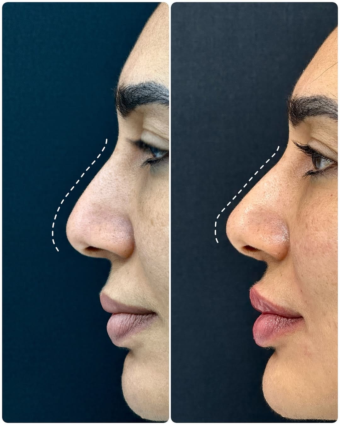 Post 2 by Dr. Beyan El Emin | Dermatology & Aesthetics on Instagram (image)