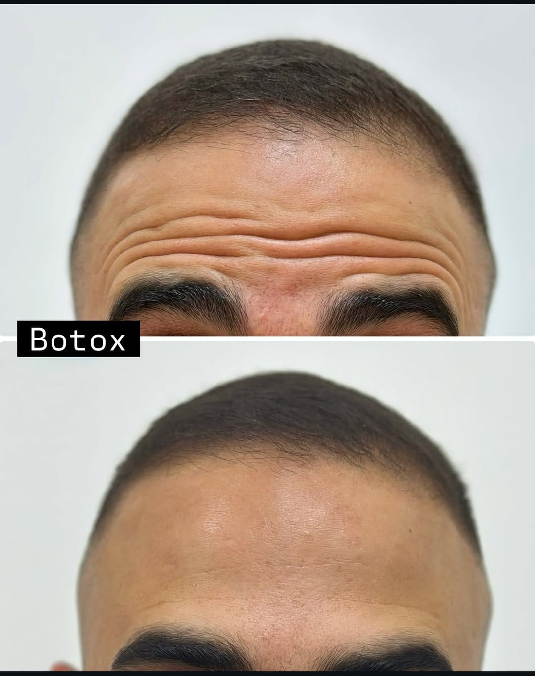 Post 8 by Dr. Beyan El Emin | Dermatology & Aesthetics on Instagram (image)