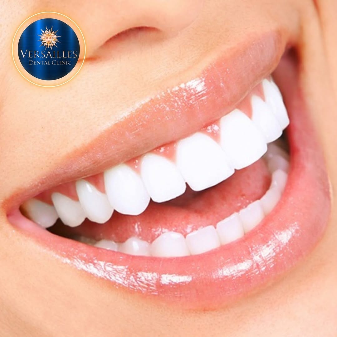 Post 7 by Versailles Dental Clinic on Instagram (image)