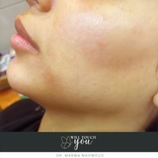 Post 4 by Dr Marwa Mahmoud 🦋🧚‍♀️ on Instagram (video)