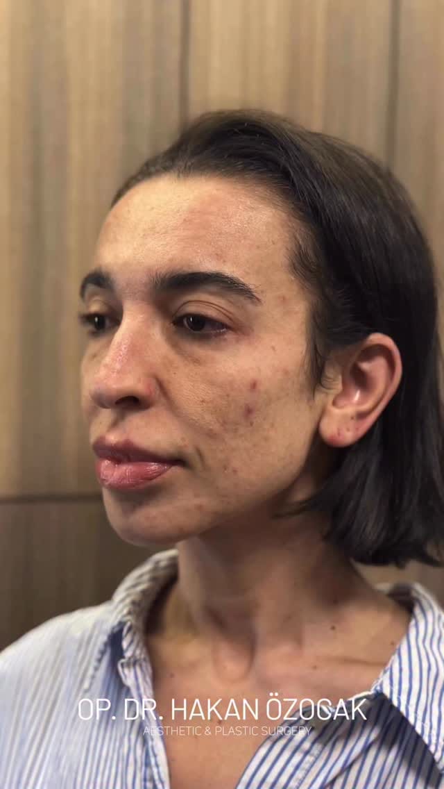 Post 5 by Hakan Özocak on Instagram (video)