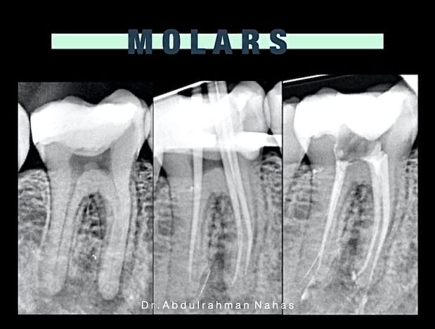 Post 2 by Dr.Abdulrahman Nahas | د.عبدالرحمن نحاس on Instagram (carousel)