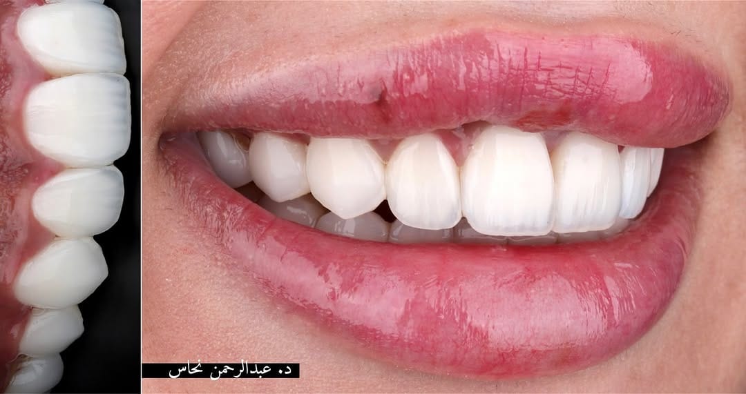 Post 7 by Dr.Abdulrahman Nahas | د.عبدالرحمن نحاس on Instagram (image)
