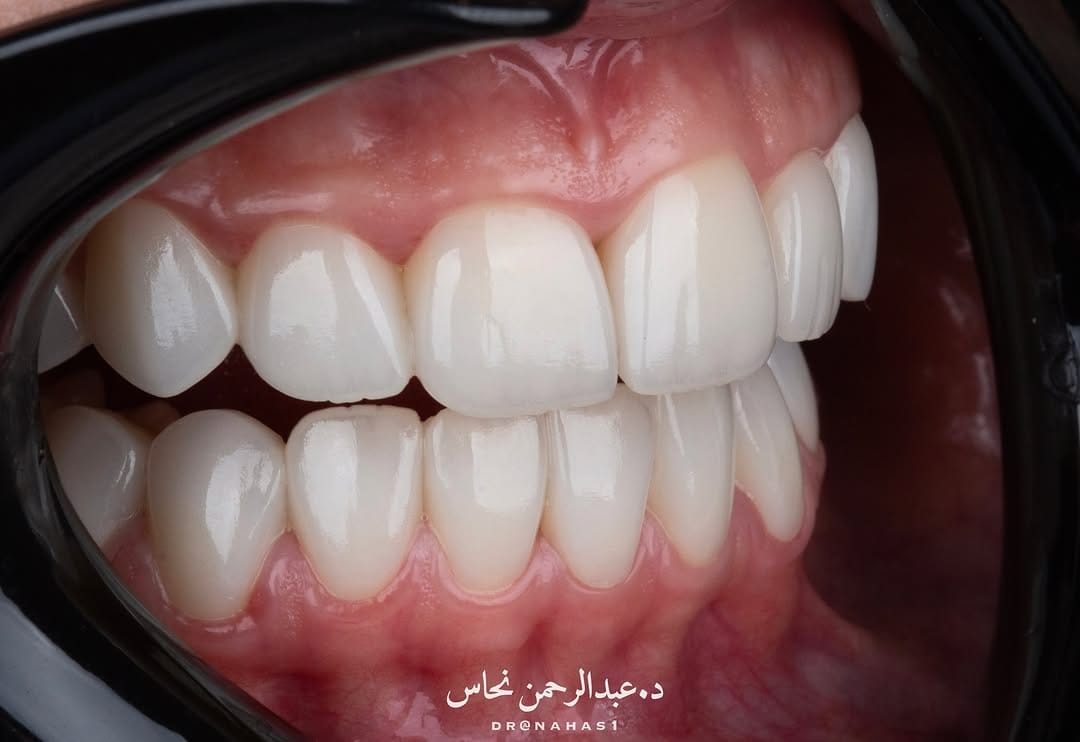 Post 3 by Dr.Abdulrahman Nahas | د.عبدالرحمن نحاس on Instagram (image)