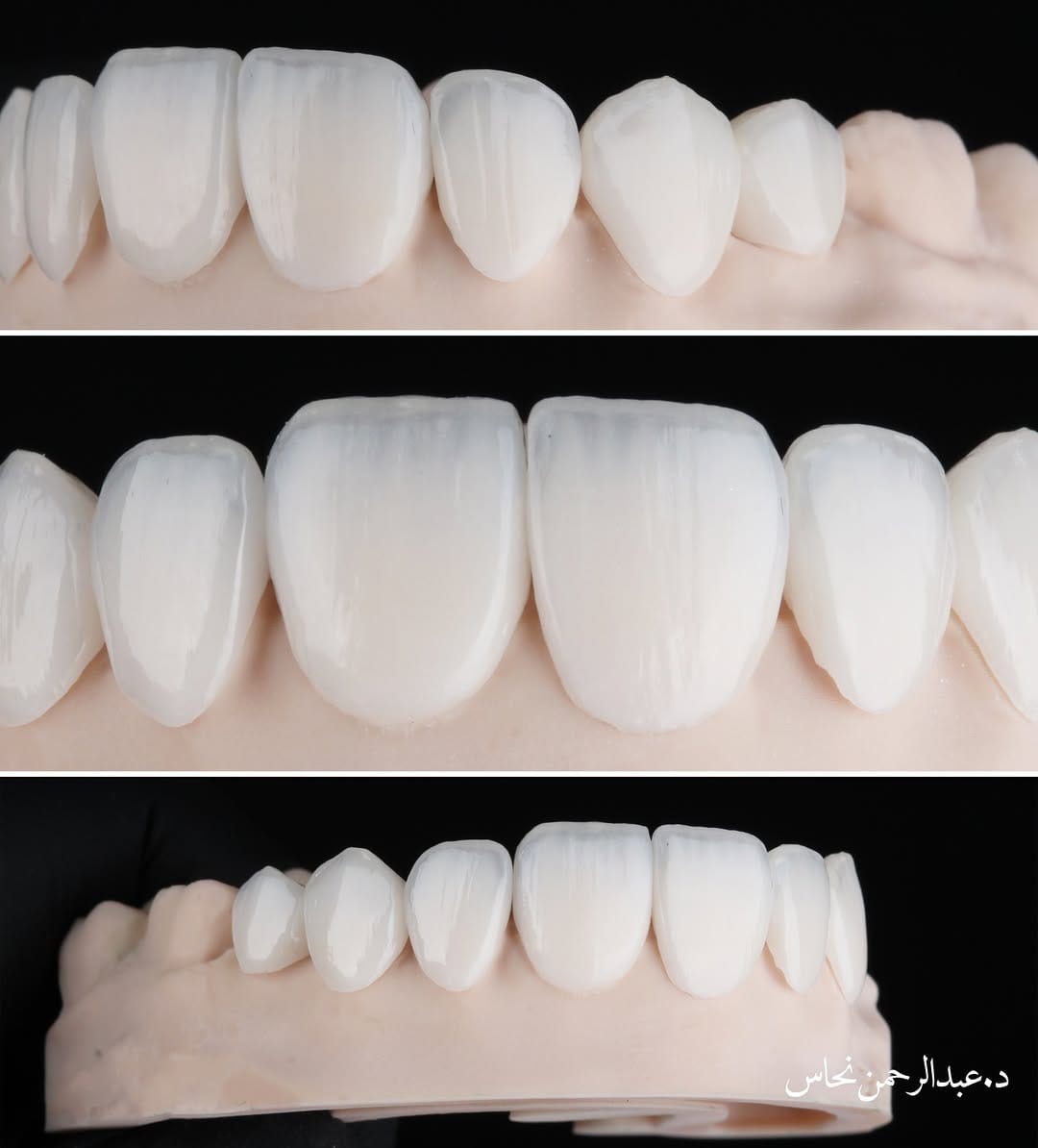Post 5 by Dr.Abdulrahman Nahas | د.عبدالرحمن نحاس on Instagram (image)