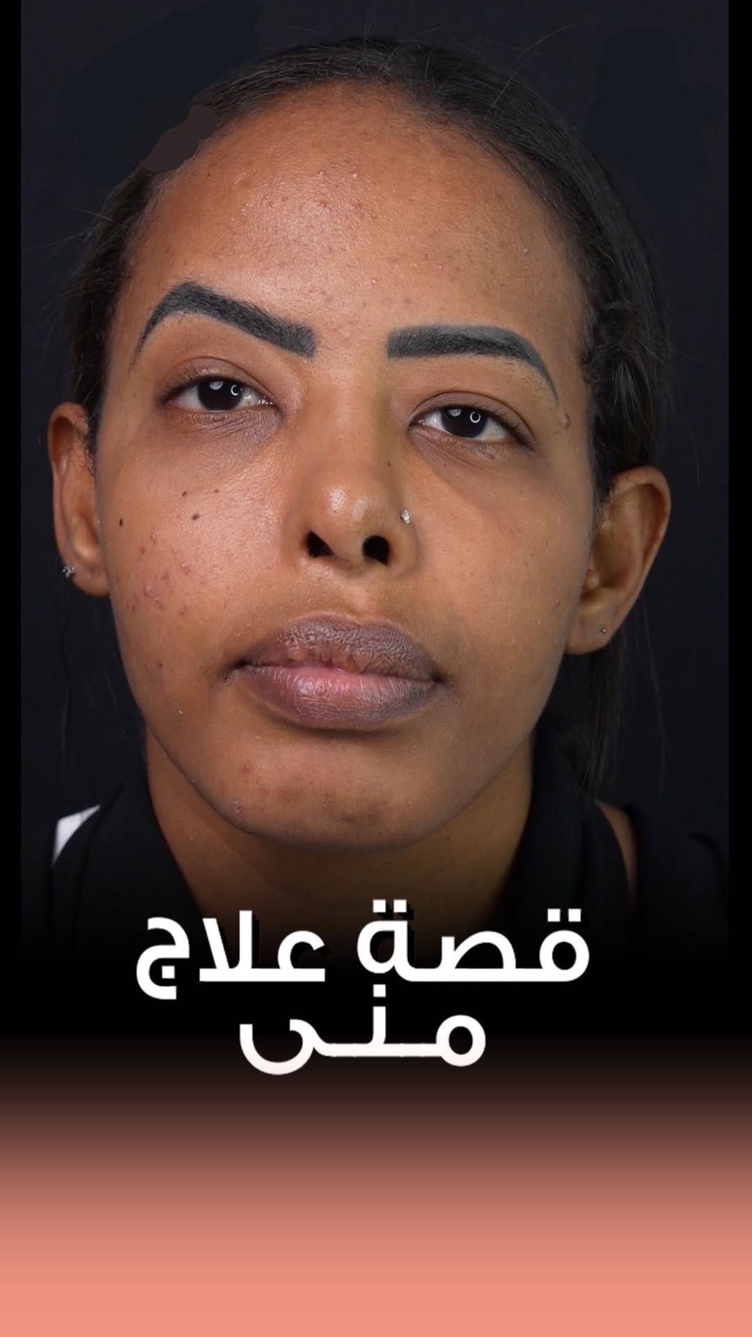 Post 9 by Dr Sherin Alhaj |د شيرين الحاج on Instagram (video)