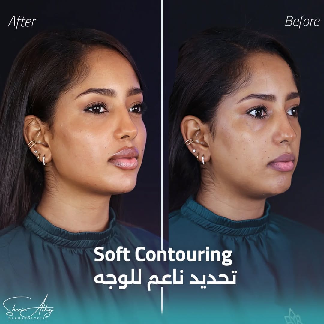 Post 10 by Dr Sherin Alhaj |د شيرين الحاج on Instagram (image)