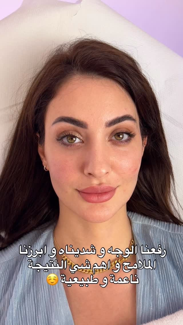 Post 8 by Dr Sherin Alhaj |د شيرين الحاج on Instagram (video)