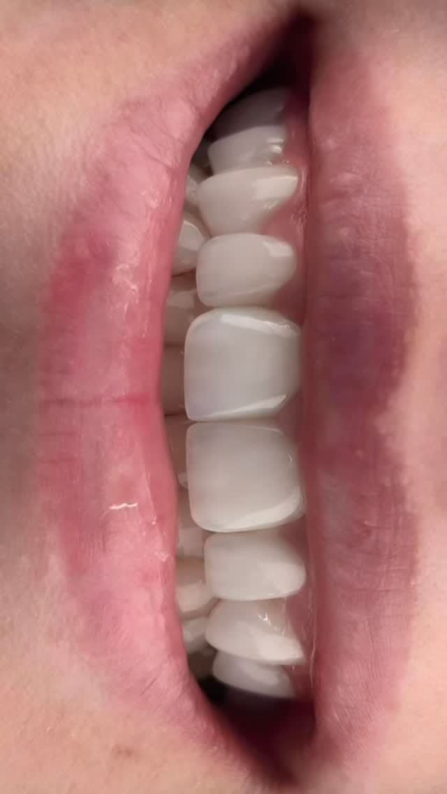 Post 3 by Dr. Batuhan Ünlüler , DDS on Instagram (video)