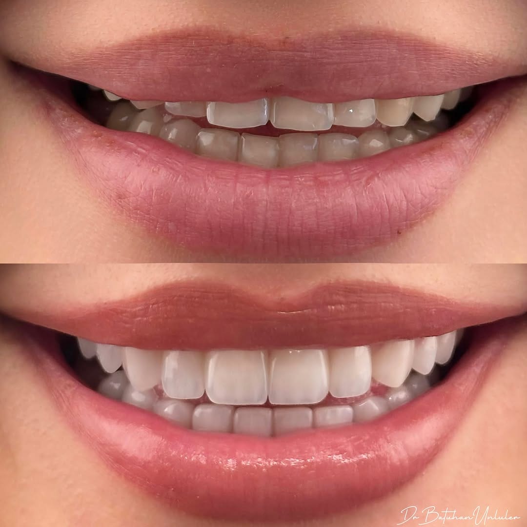 Post 2 by Dr. Batuhan Ünlüler , DDS on Instagram (image)