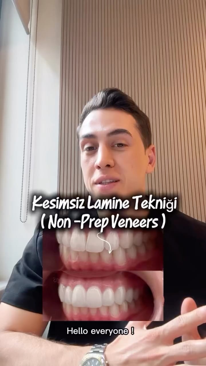 Post 4 by Dr. Batuhan Ünlüler , DDS on Instagram (video)