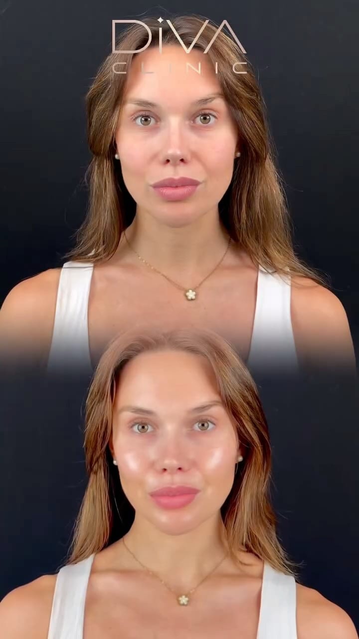 Post 5 by Dr Maxine Fernandes on Instagram (video)