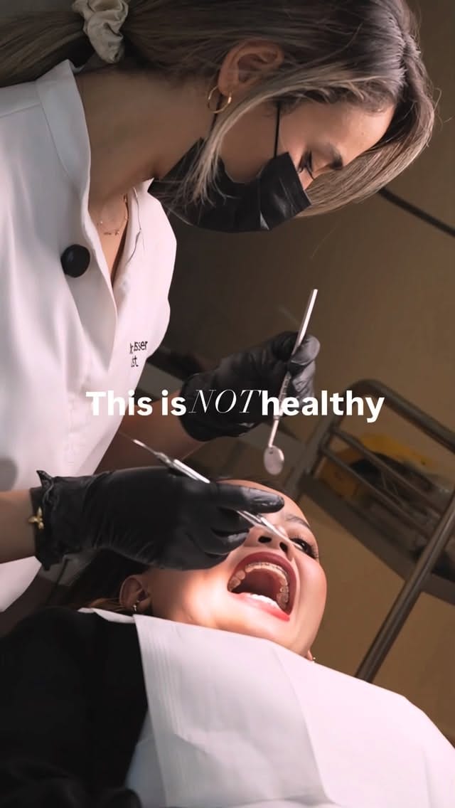 Post 5 by Dr. Sana Nasser • Dentist on Instagram (video)