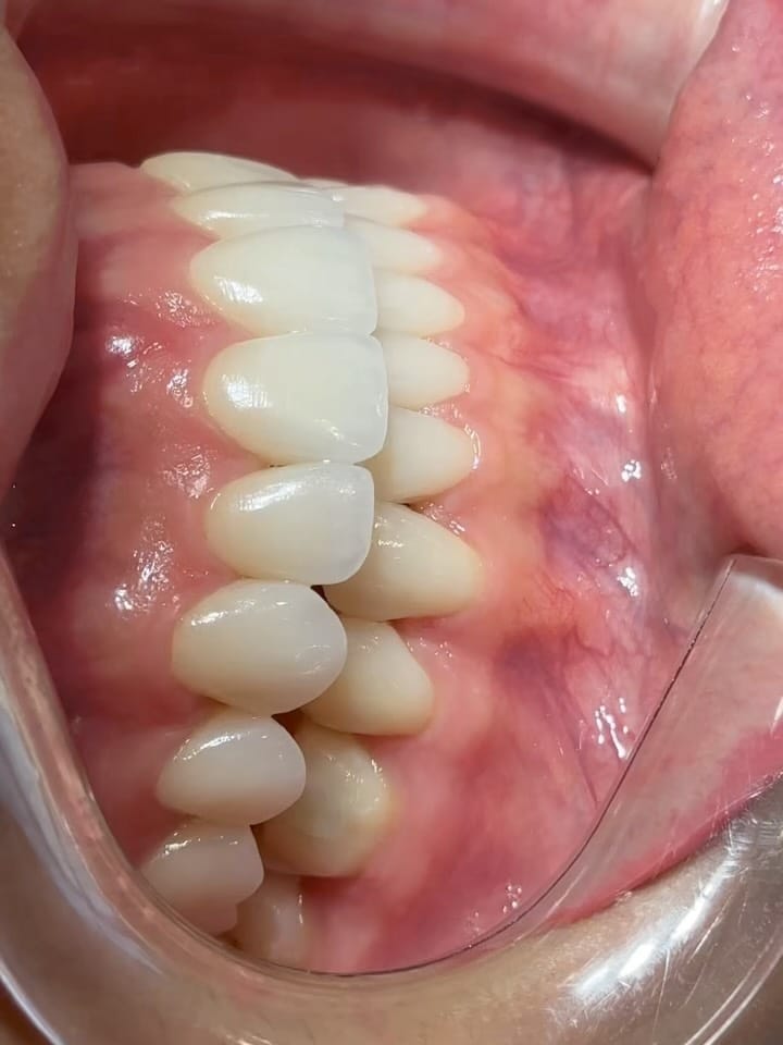 Post 3 by Dr Jamshiddin Dubai Dentist on Instagram (carousel)