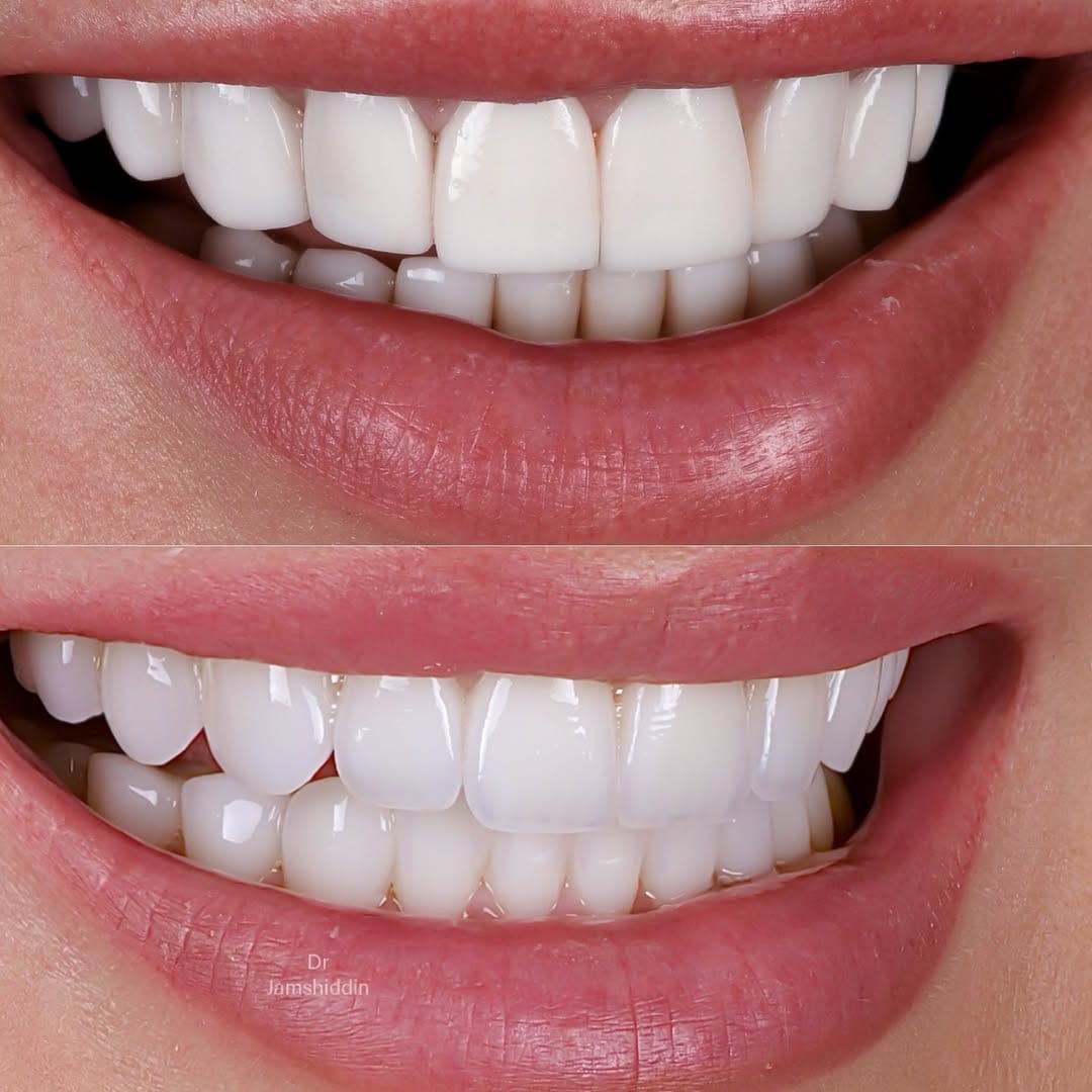 Post 2 by Dr Jamshiddin Dubai Dentist on Instagram (image)