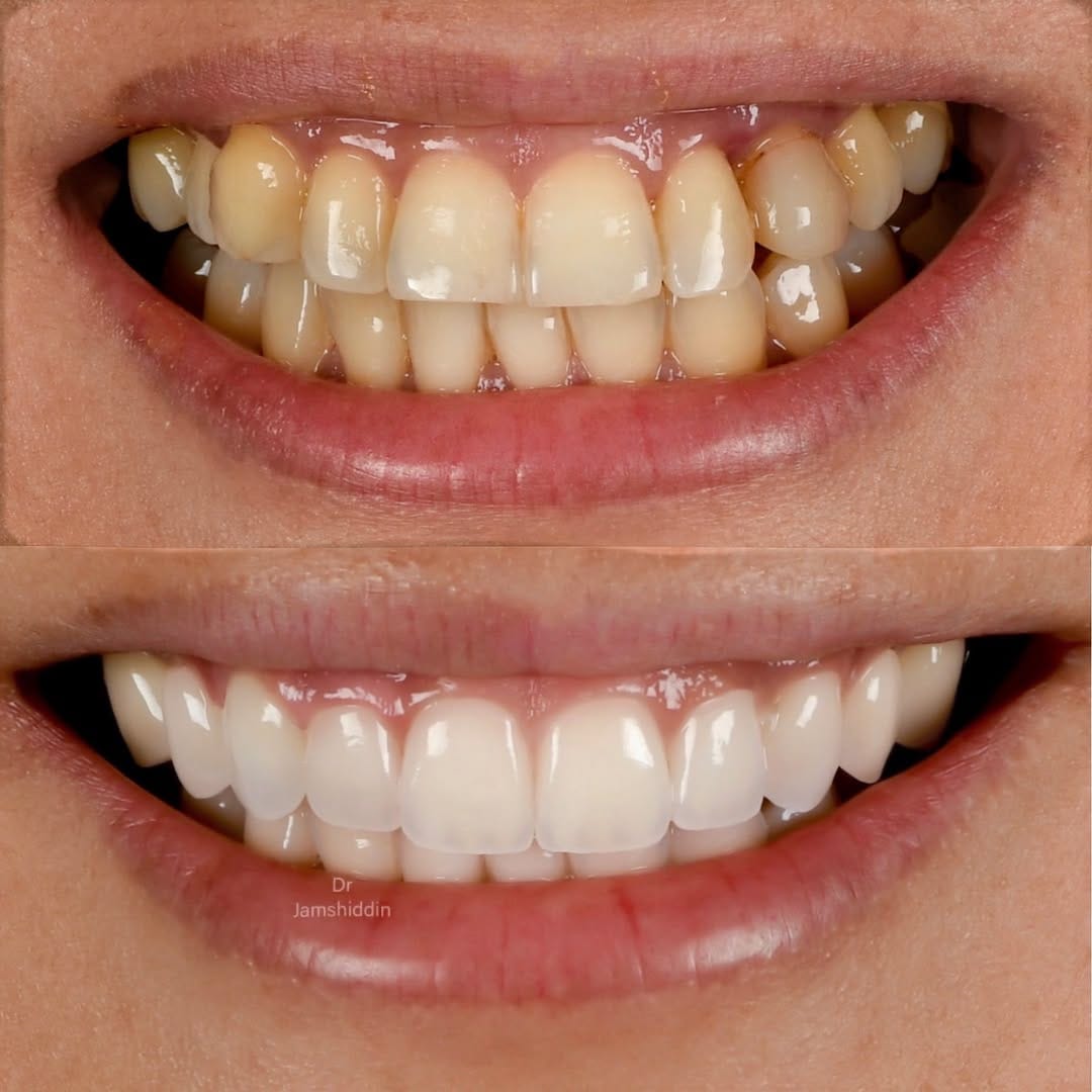 Post 4 by Dr Jamshiddin Dubai Dentist on Instagram (image)