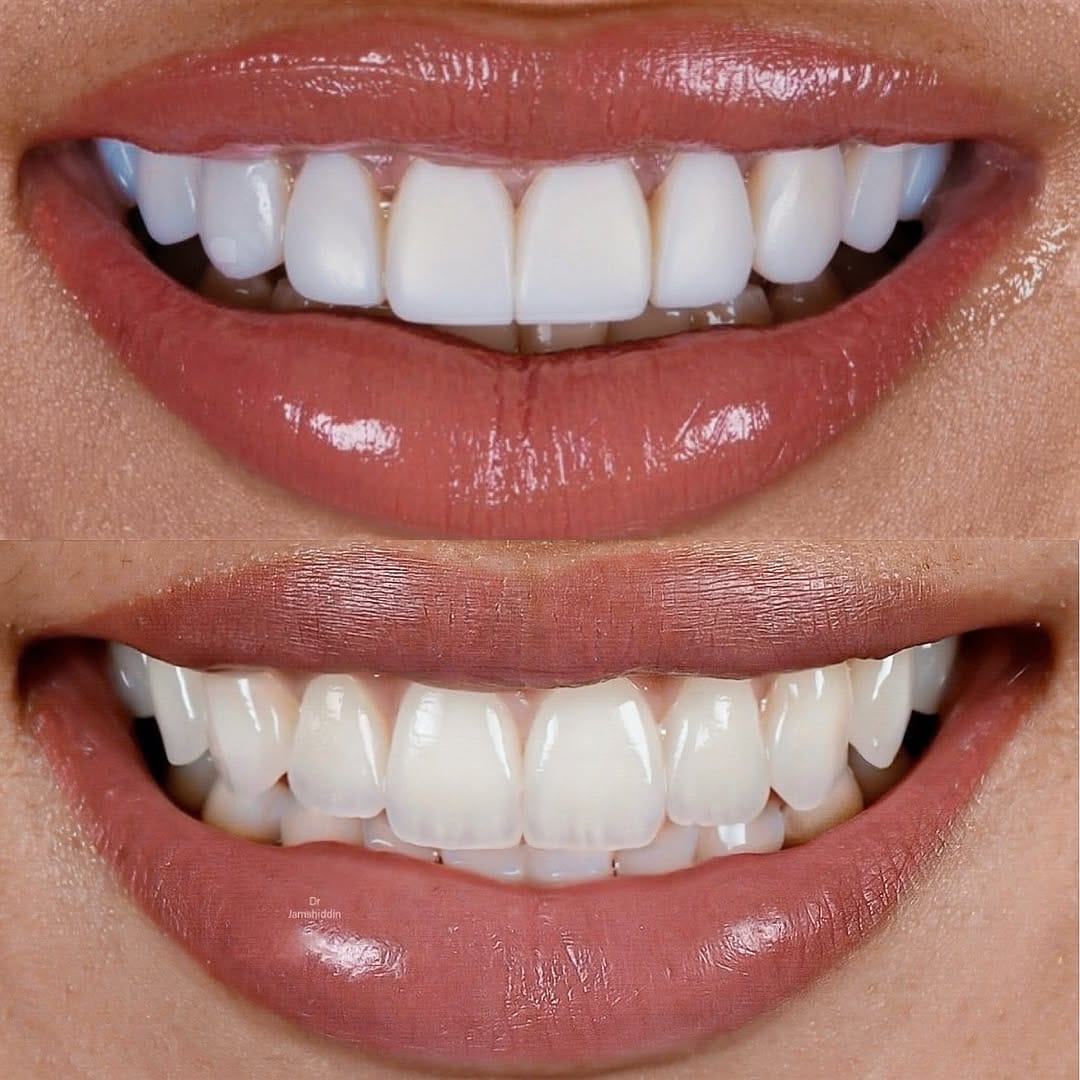 Post 10 by Dr Jamshiddin Dubai Dentist on Instagram (image)
