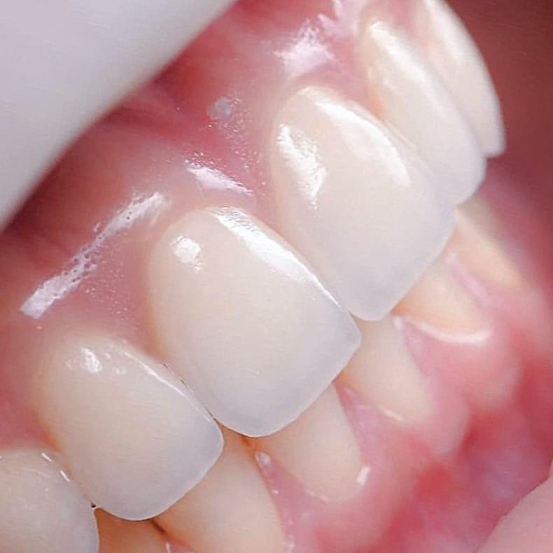 Post 6 by Dr Jamshiddin Dubai Dentist on Instagram (image)