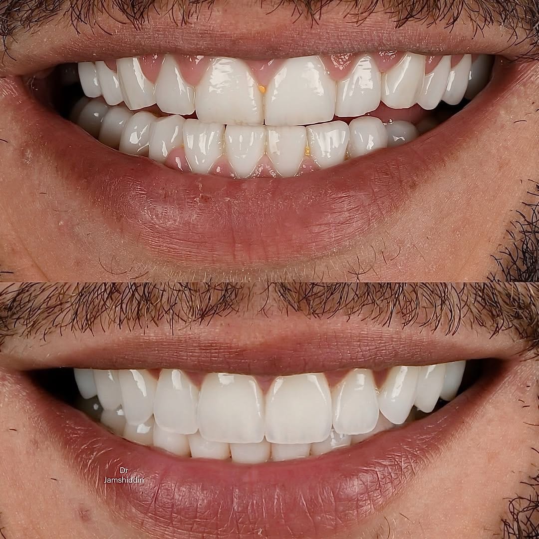 Post 9 by Dr Jamshiddin Dubai Dentist on Instagram (image)